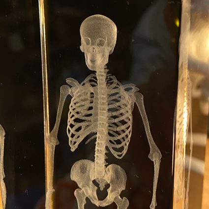 RADIOGRAPHIE SQUELETTE 3D CRISTAL 29