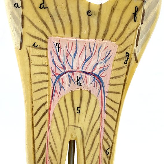 MODÈLE ANATOMIQUE D'UNE DENT - DOCTEUR AUZOUX - V0224