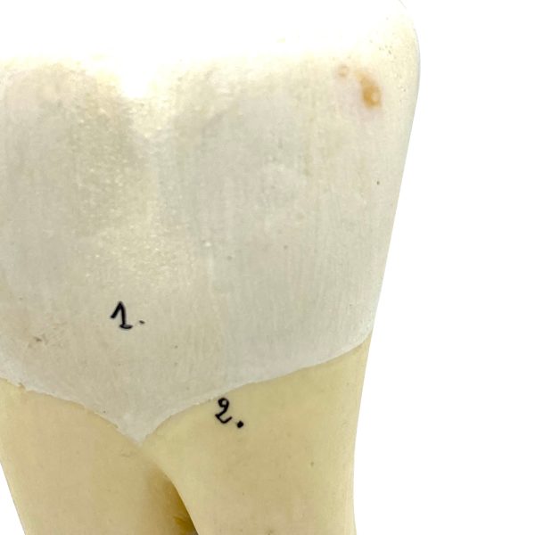 MODÈLE ANATOMIQUE D'UNE DENT - DOCTEUR AUZOUX - V0222