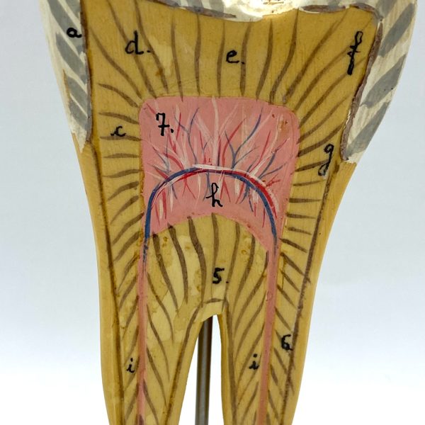 MODÈLE ANATOMIQUE D'UNE DENT - DOCTEUR AUZOUX - V0223