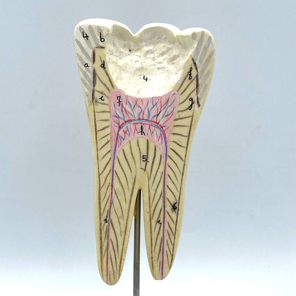MODÈLE ANATOMIQUE D'UNE DENT - DOCTEUR AUZOUX - V0222